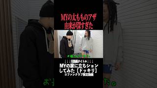 MYくんの太ももにあるアザのワケが流石に深すぎる